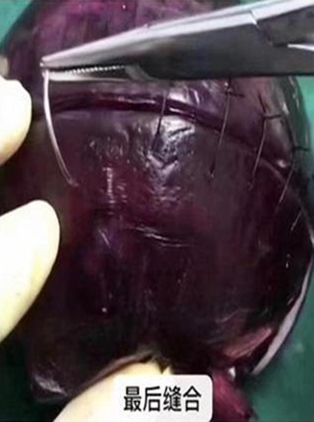 你的育儿经|选剖腹产不疼？这根10厘米的麻醉针仅仅是开始，疼到你怀疑人生