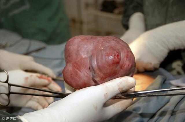 常见的乳腺良性肿瘤有哪些,如何治疗,与乳腺癌有何关系?