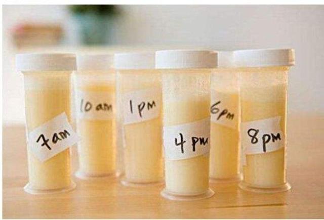 黄色，乳白色，母乳颜色跟营养有关吗？你的是什么颜色的？