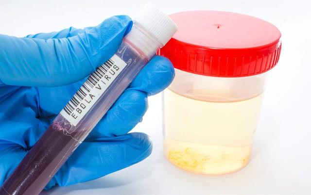 孕早期B超检查都查了什么？你想知道的这些事儿都告诉你了！