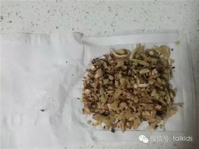 生姜敷脚心治感冒？妈妈专家共同验证