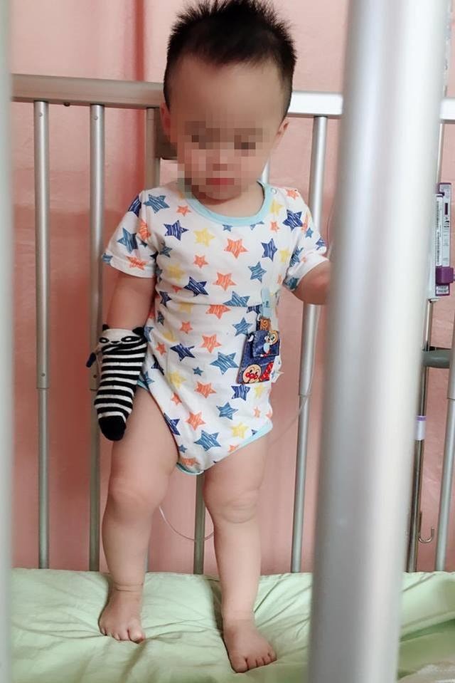 请先洗手再接触小孩！差点蜂窝性组织扩散全身，这病感染恐致死