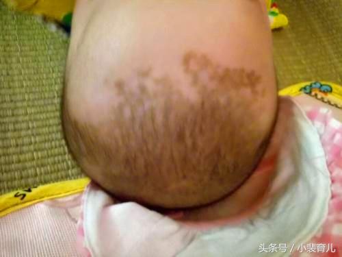 出生1—2个月的宝宝出现这些情况是正常的生理现象，不用太担心