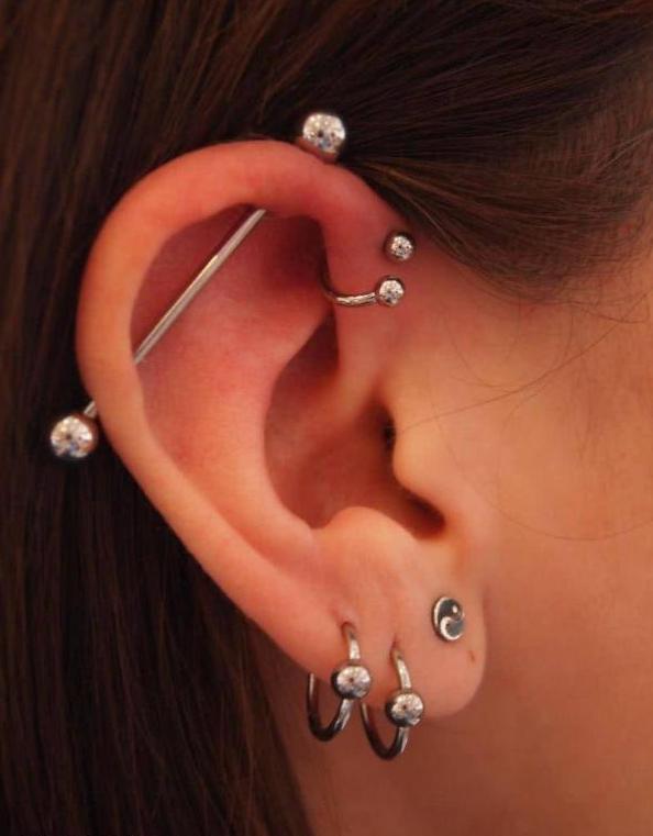 X光检查暴露女儿隐藏多时的秘密 母亲痛心疾首