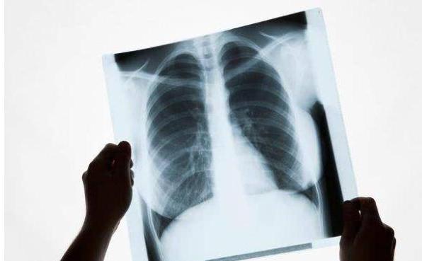 X光检查暴露女儿隐藏多时的秘密 母亲痛心疾首