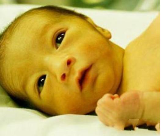 想避免新生儿黄疸，孕妈要多吃这几种食物，第三种很多孕妈想不到