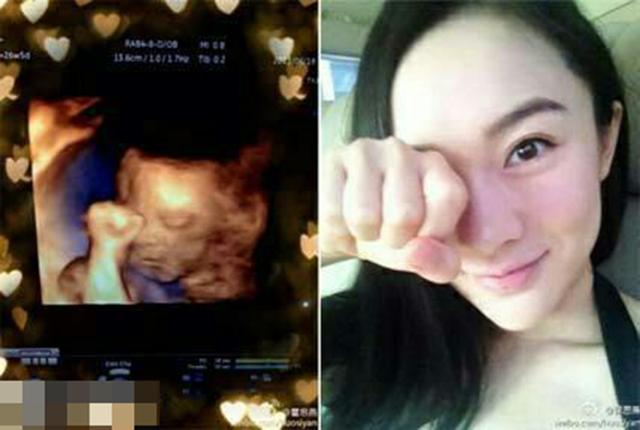 四维顺利归来，准妈妈孕期拍四维都经历了什么？你家胎宝配合吗？