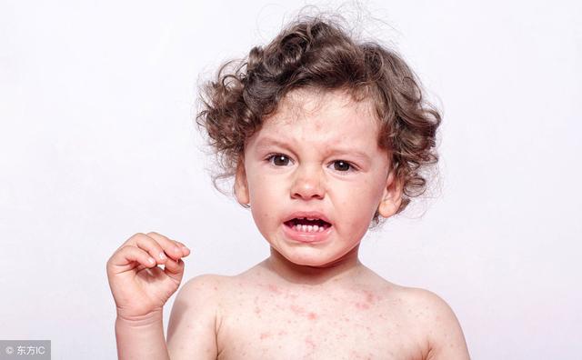 现代孩子越来越容易过敏，到底怎么回事？