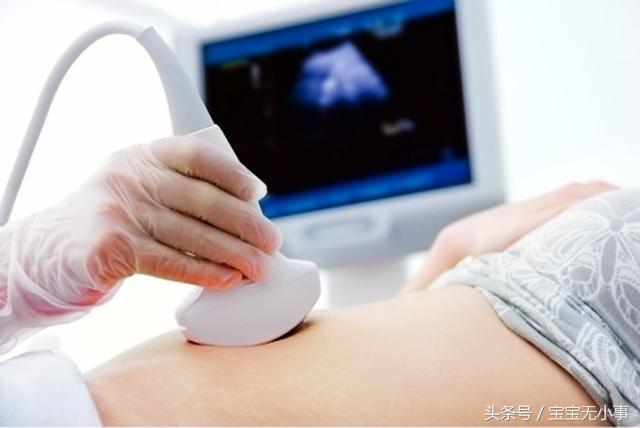 关于NT检查，孕妇要了解这些，不然做了也白做