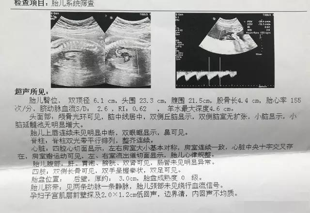 胎儿大排畸彩超单怎么看？医生教你看懂11个指标，孕妇明白了