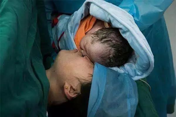 生完二胎医生通知“最好别要三胎了！”剖腹产子宫壁薄有多可怕？