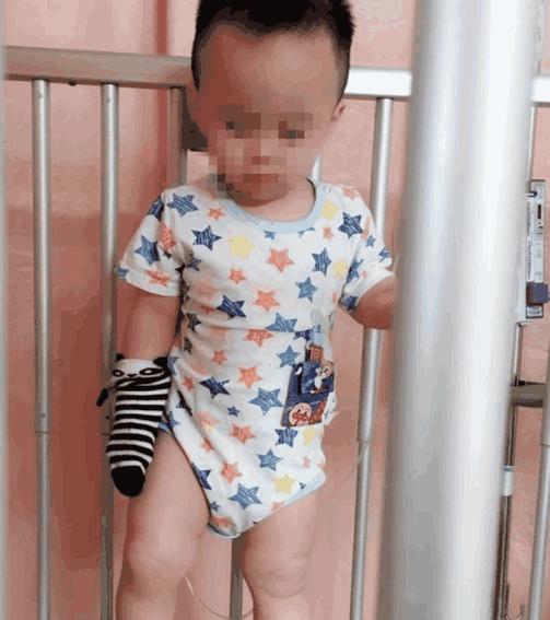 接触小孩请先洗手，孩子差点蜂窝性组织扩散全身，感染这病恐致死
