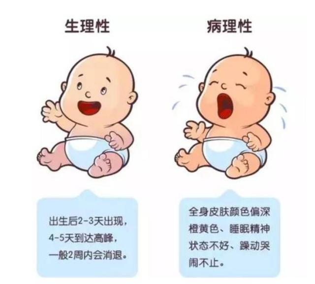 生理性黄疸和病理性黄疸，如何区分？