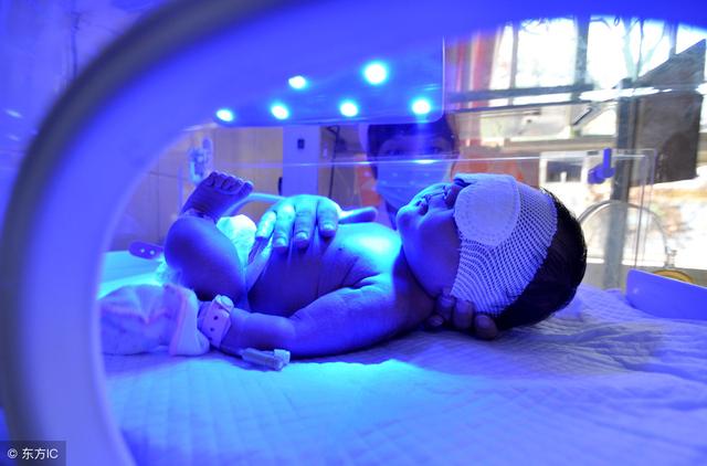 当宝宝出现新生儿黄疸，新手妈妈别着急，对症治疗是关键