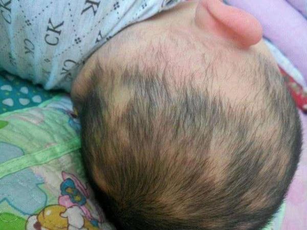 了解新生儿这5种生理现象，让你少跑几趟医院，看完果断收藏了！