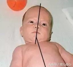 宝宝的头总是歪向一侧，不会“歪脖子”吧？
