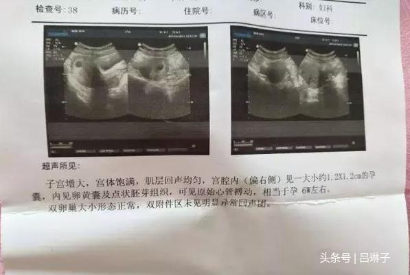 老婆笔下的怀孕日记，看完我哭了！