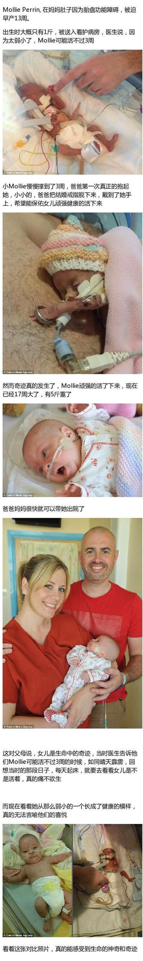 仅1斤的婴儿存活，医生都感到惊讶，看完泪盈满眶