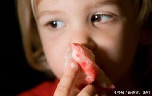 孩子流鼻血要仰头举手？错了错了，快来看看正确的做法吧