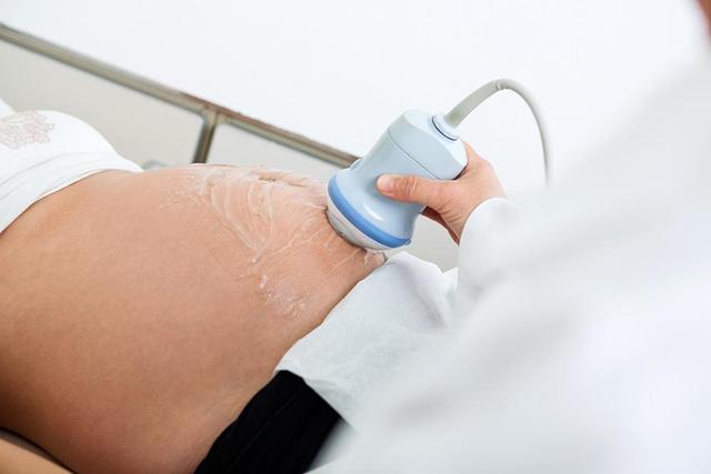 产检过了这3关，孕妈宝宝都健康