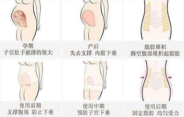 产后使用束腹带的正确姿势，宝妈们都做对了吗？用错会让身体受损
