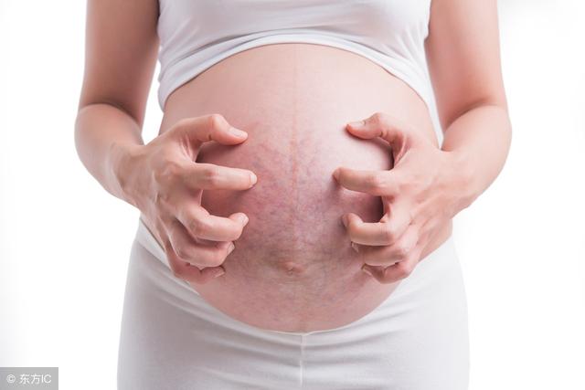 听说，秋季这4类准妈妈更容易长妊娠纹？这样吃能预防妊娠纹