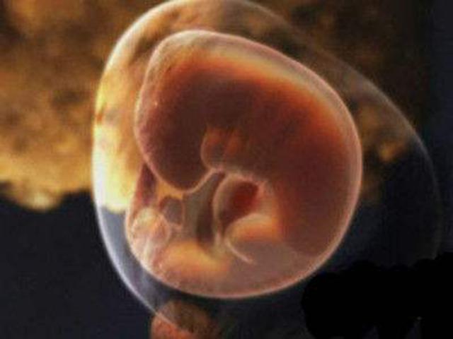 怀孕1个月胎儿和孕妇的变化有哪些？疾病重点：排查是不是宫外孕