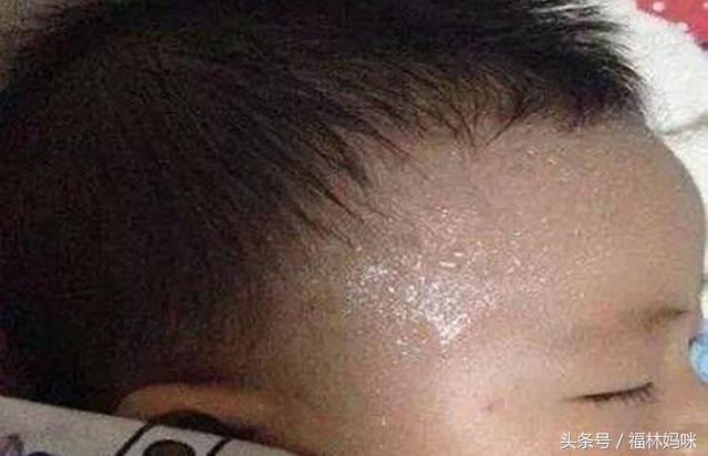 大多数宝宝不会缺钙！宝宝出汗多是热的，别把锅都甩给“缺钙
