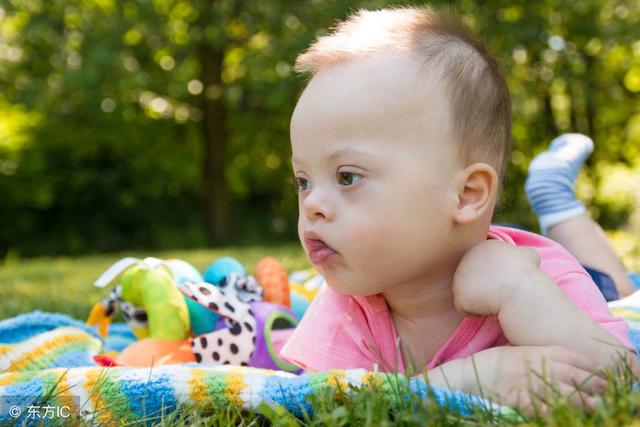 唐氏综合症的主要表现有哪些？