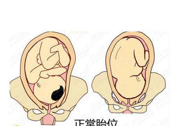 顺产受罪少？了解剖腹产的这几个好处后，孕妈可能就不会这么想了