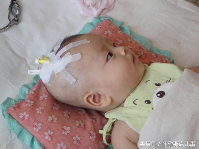 宝宝大便异样，检查结果惊人，医生直言：全是因为妈妈爱干净导致