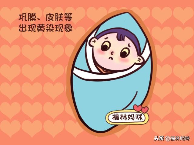 孕期防“黄疸”可以吃鹅蛋？为了避免新生儿黄疸，孕妈要清楚！