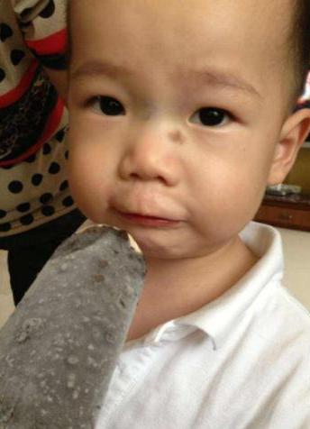 “鼻有青筋，积食临门”，孩子鼻梁有青筋真的有问题吗？