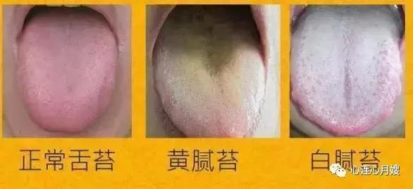 如何看舌头判断孩子身体状况，有图！
