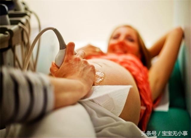 孕期没出现过这3种情况？恭喜你，胎儿发育得真好