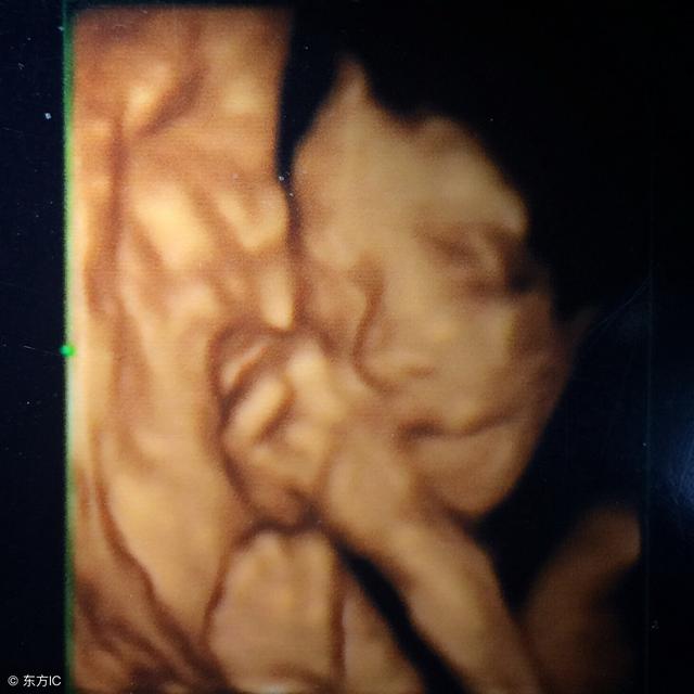 做四维彩超时宝宝不配合，该怎么办？孕妈这样做，一次通过四维！