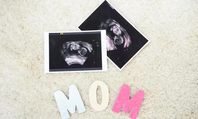 孕检B超、彩超、三维、四维，都要做？真相我来告诉你！