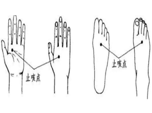 官宣！孩手里有个“止咳开关”，家长轻按一下，孩子咳嗽好得快！