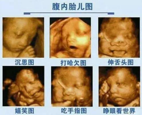 高智商的宝宝在孕期会有3种表现,如果你的宝宝有,就偷着乐吧!