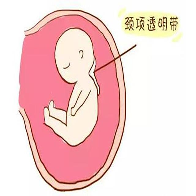 孕产说：怀孕了，需要做什么产检项目？大概需要多少钱？