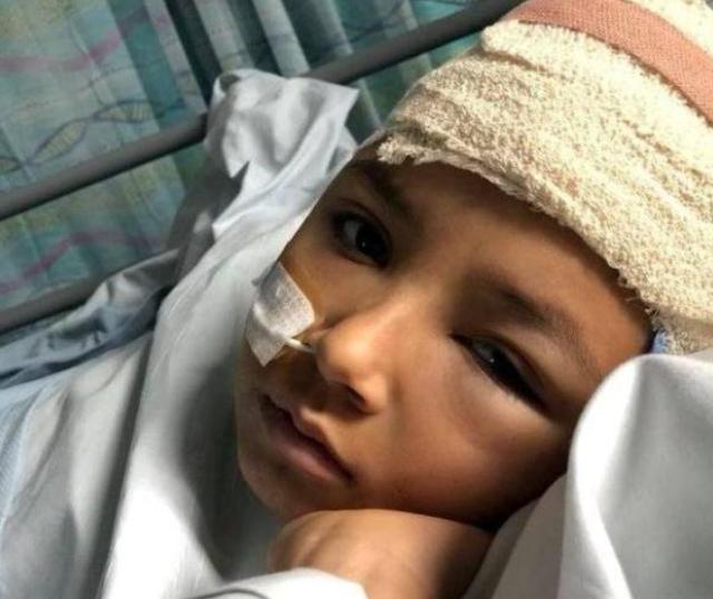 小男孩癫痫病每天发病百余次 母亲一个狠心决定竟救了他