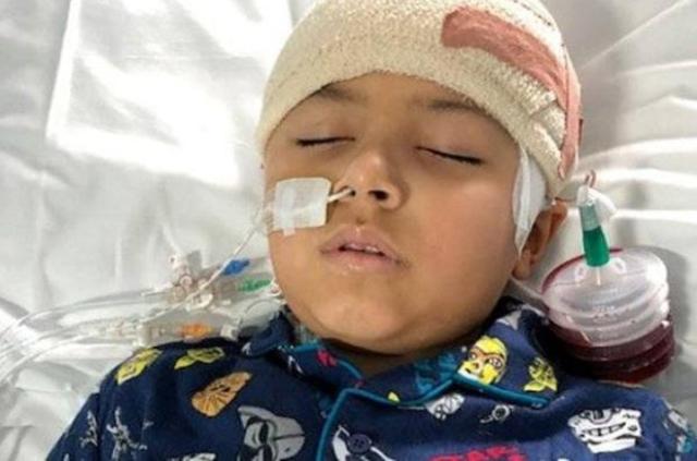 小男孩癫痫病每天发病百余次 母亲一个狠心决定竟救了他