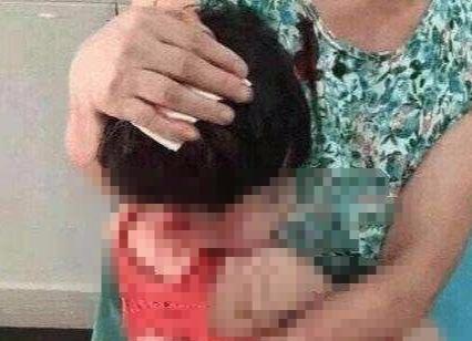 女儿总是挠屁股，妈妈以为是蛔虫，医生一番话，让宝妈当场石化