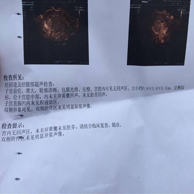 为什么孕检未见胚芽以及卵黄囊的呢？急死我了，宝宝不会有事吧？