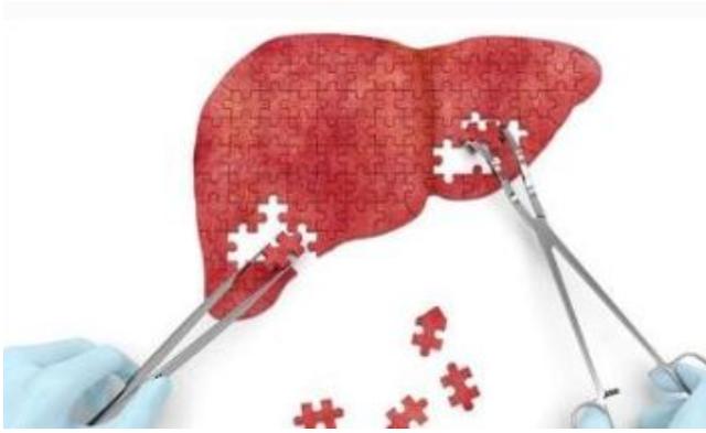 7月大婴儿肝衰竭陷危机，母亲捐肝配型成功，移植手术却又遇阻？