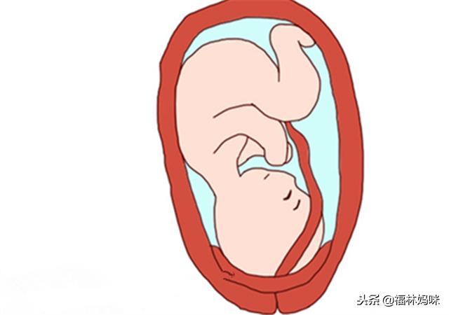 你怀孕时胎盘位置在哪里？这种情况就有些危险了，孕妈要当心！