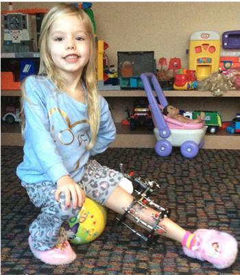 妈妈每天折断女儿腿3次，坚称这是值得的！