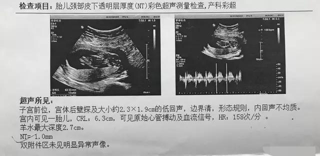 孕妇多长时间去做一次彩超？整个孕期要做多少次彩超？宝妈全分享
