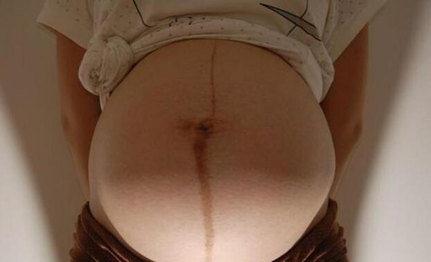 孕妇肚脐中间有条黑线,为啥有的笔直一条,有的却偏左或偏右?