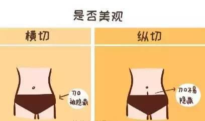 头胎横切口剖腹产，二胎可以竖切口吗？看这4大区别再决定